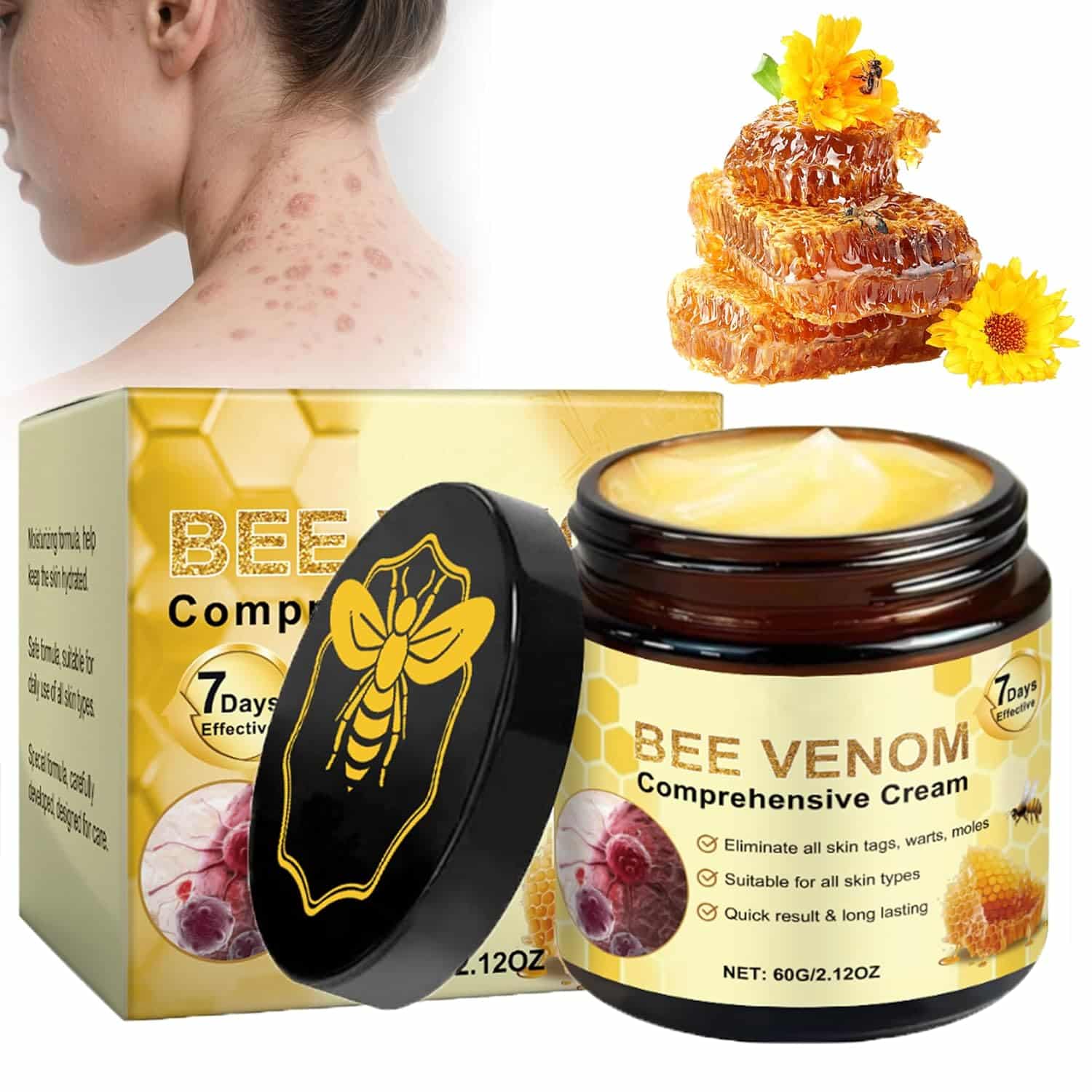 Bee Venom Comprehensive Cream, Bee Venom Skin Treatment Cream, All-in-One, Lifting & Firming, Anti-Aging Moisturizing, Effectively reduces all types of skin blemishes